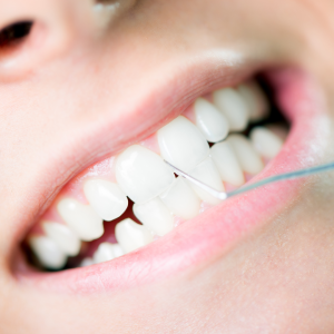 dental cleaning